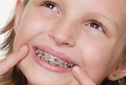 Diş Teli Ağız Yarası Belirtileri ve Tedavisi